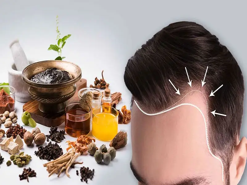 گیاهان دارویی برای پرپشت شدن مو و افزایش رشد مو 1 گیاهان دارویی برای پرپشت شدن مو و افزایش رشد مو