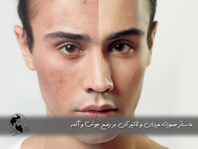 ماساژ صورت مردان و تأثیر آن بر رفع جوش و آکنه